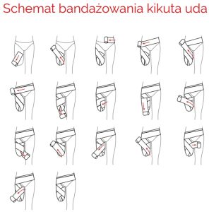 Schemat bandażowania kikuta uda